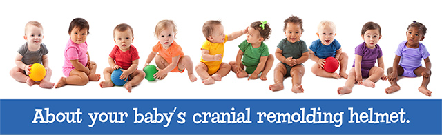 About your baby's cranial remolding helmet.